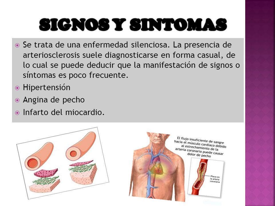 signos de la enfermedad coronaria signos de la enfermedad coronaria
